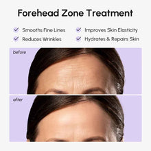 Load image into Gallery viewer, Anti-Wrinkle Forehead Patches