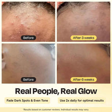 Load image into Gallery viewer, Advanced Brightening Moisturizer
